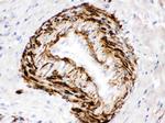 SMYD3 Antibody in Immunohistochemistry (Paraffin) (IHC (P))