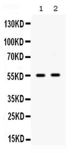 SMYD3 Antibody in Western Blot (WB)