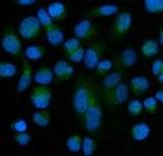 SOD3 Antibody in Immunocytochemistry (ICC/IF)