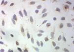 SOD3 Antibody in Immunocytochemistry (ICC/IF)