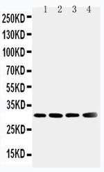 SOD3 Antibody in Western Blot (WB)