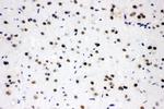 SRSF1 Antibody in Immunohistochemistry (Paraffin) (IHC (P))