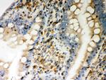 STIM1 Antibody in Immunohistochemistry (Paraffin) (IHC (P))