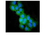 SULT2B1 Antibody in Immunocytochemistry (ICC/IF)