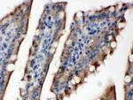 SULT2B1 Antibody in Immunohistochemistry (Paraffin) (IHC (P))