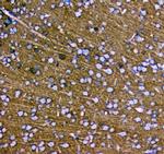 Synaptotagmin 1 Antibody in Immunohistochemistry (Paraffin) (IHC (P))