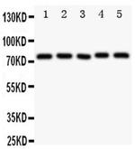 TEC Antibody in Western Blot (WB)