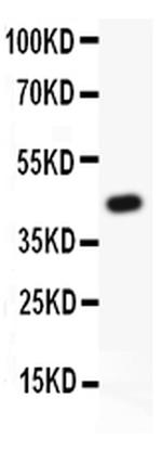 TIE2 (TEK) Antibody in Western Blot (WB)