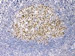 TRF2 Antibody in Immunohistochemistry (Paraffin) (IHC (P))