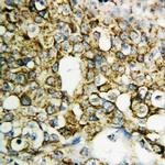 TFPI2 Antibody in Immunohistochemistry (Paraffin) (IHC (P))