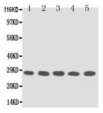 TFPI2 Antibody in Western Blot (WB)