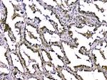 TGF beta-2 Antibody in Immunohistochemistry (Paraffin) (IHC (P))