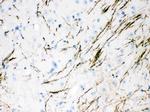 Tyrosine Hydroxylase Antibody in Immunohistochemistry (Paraffin) (IHC (P))