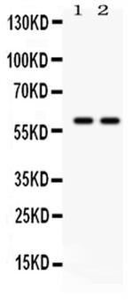 Tyrosine Hydroxylase Antibody in Western Blot (WB)