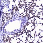 Talin 1 Antibody in Immunohistochemistry (Paraffin) (IHC (P))