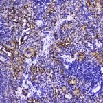 Talin 1 Antibody in Immunohistochemistry (Paraffin) (IHC (P))