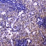 Talin 1 Antibody in Immunohistochemistry (Paraffin) (IHC (P))