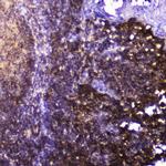 Talin 1 Antibody in Immunohistochemistry (Paraffin) (IHC (P))