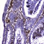 Talin 1 Antibody in Immunohistochemistry (Paraffin) (IHC (P))