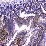 Talin 1 Antibody in Immunohistochemistry (Paraffin) (IHC (P))