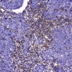 Talin 1 Antibody in Immunohistochemistry (Paraffin) (IHC (P))