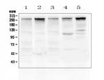 Talin 1 Antibody in Western Blot (WB)