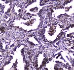 TLR1 Antibody in Immunohistochemistry (Paraffin) (IHC (P))