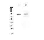 TLR1 Antibody in Western Blot (WB)