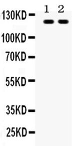 TLR8 Antibody in Western Blot (WB)