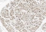 TNFAIP1 Antibody in Immunohistochemistry (Paraffin) (IHC (P))