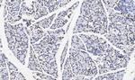 TNFAIP1 Antibody in Immunohistochemistry (Paraffin) (IHC (P))