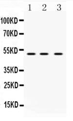 DR4 Antibody in Western Blot (WB)