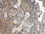 RANK (CD265) Antibody in Immunohistochemistry (Paraffin) (IHC (P))