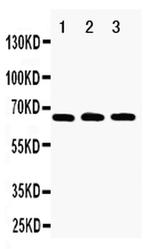 RANK (CD265) Antibody in Western Blot (WB)