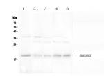 BAFF Receptor (CD268) Antibody in Western Blot (WB)