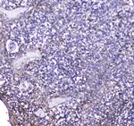 BCMA Antibody in Immunohistochemistry (Paraffin) (IHC (P))