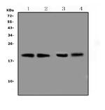 BCMA Antibody in Western Blot (WB)