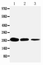 TNFR1 Antibody in Western Blot (WB)