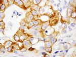 TNFR2 Antibody in Immunohistochemistry (Paraffin) (IHC (P))