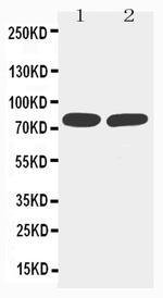 TNFR2 Antibody in Western Blot (WB)