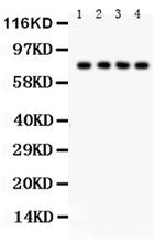 TNFR2 Antibody in Western Blot (WB)