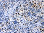 TNFR2 Antibody in Immunohistochemistry (Paraffin) (IHC (P))