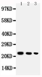 BAFF (BLyS) Antibody in Western Blot (WB)