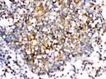 CD153 Antibody in Immunohistochemistry (Paraffin) (IHC (P))