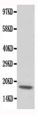 Cardiac Troponin C Antibody in Western Blot (WB)