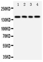 Tenascin R Antibody in Western Blot (WB)