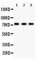 p73 Antibody in Western Blot (WB)