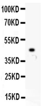 p73 Antibody in Western Blot (WB)