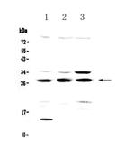 TPMT Antibody in Western Blot (WB)