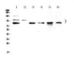 TPX2 Antibody in Western Blot (WB)